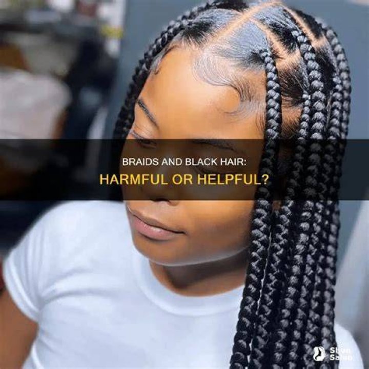 Are braids bad for black hair?