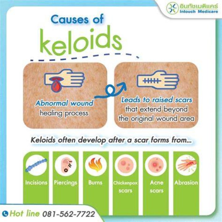 Are keloids cancerous?