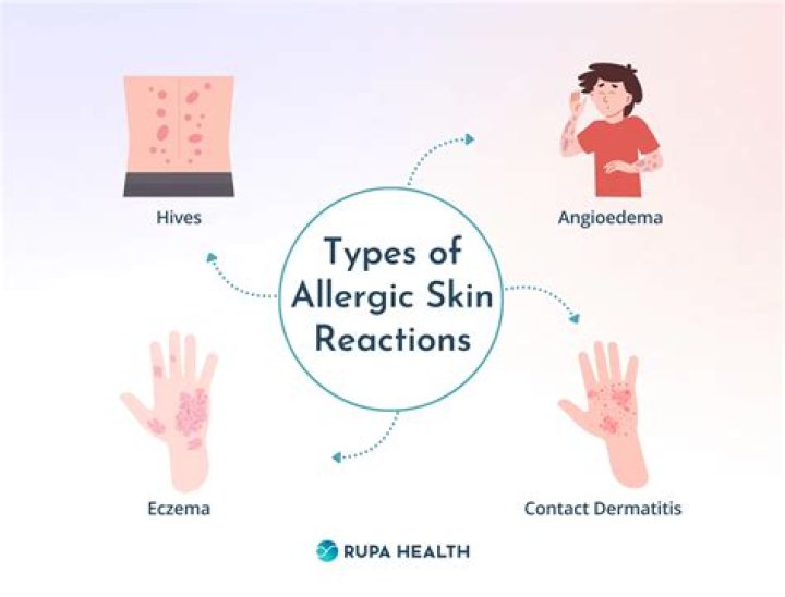 Are some people allergic to argan oil?