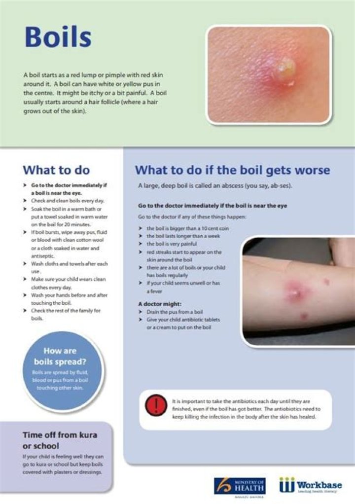 Can a boil be cancerous?