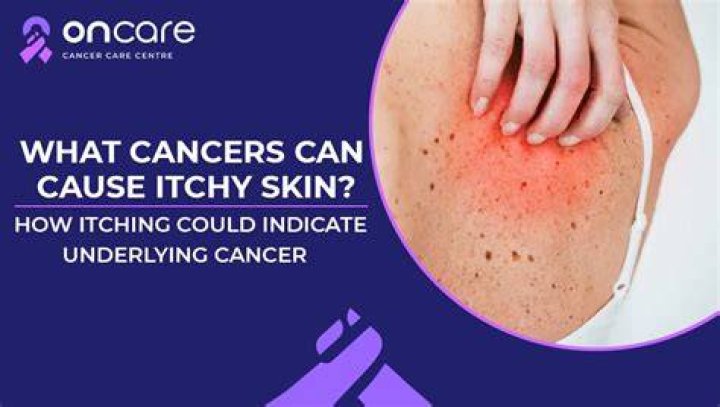 Can gut issues cause itchy skin?