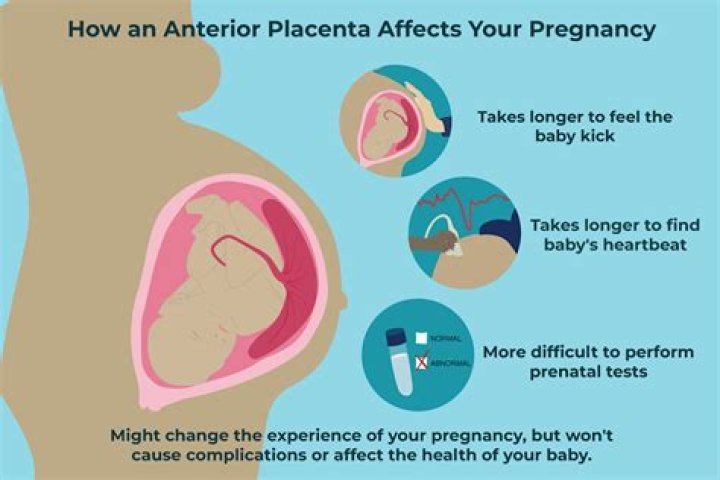 Can I keep my placenta after birth?