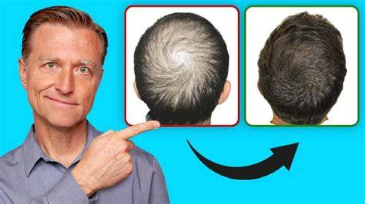 Can I regrow hair at 55?