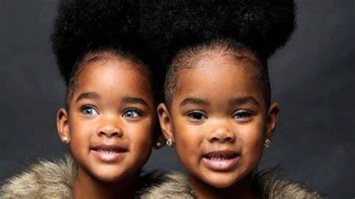 Can identical twins have different color eyes?