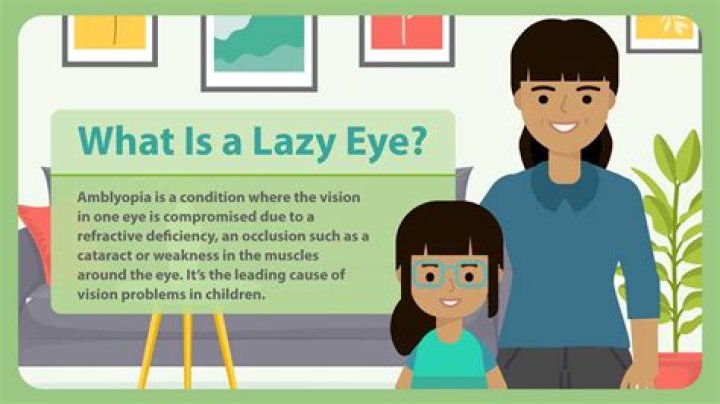 Can lazy eye be treated in age 12?