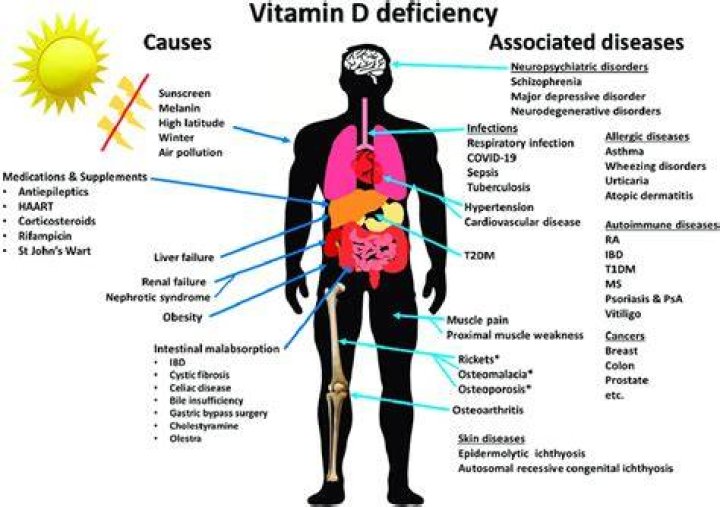 Can vitamin D deficiency cause palpitations?