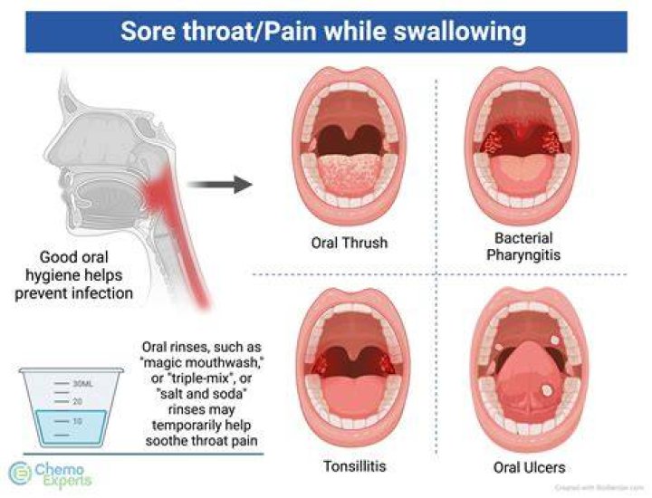 Can you get a sore throat from a bonfire?