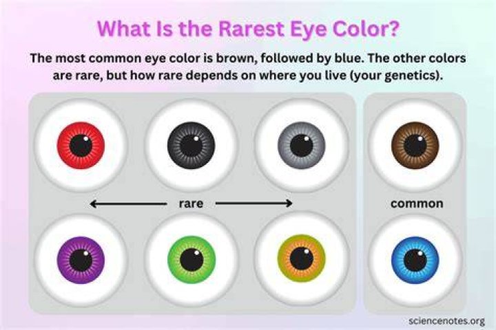 Can you have black eyes color?