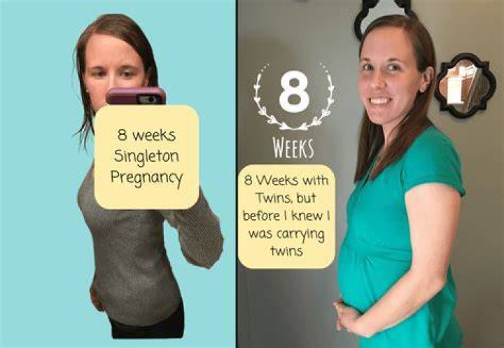 Do you eat more when pregnant with twins?