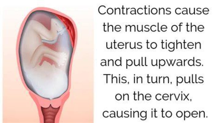 Does a natural birth hurt?