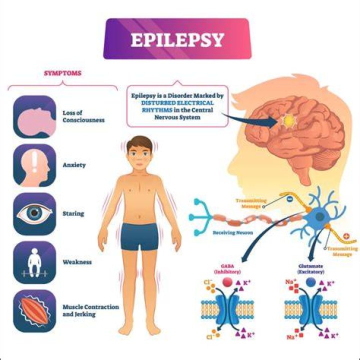 Does epilepsy damage the brain?