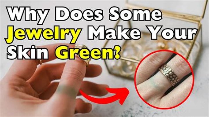 Does gold turn green?
