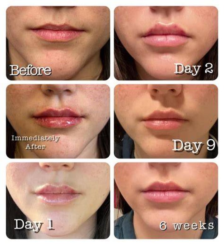 Does Lip go back to school?