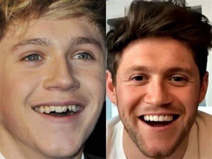 Does Niall Horan have an ear piercing?