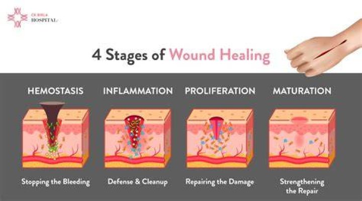 Does pain mean a wound is healing?