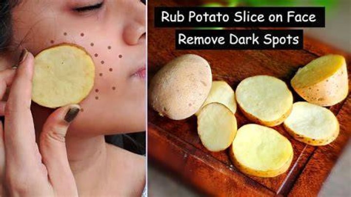 Does rubbing potato remove dark circles?