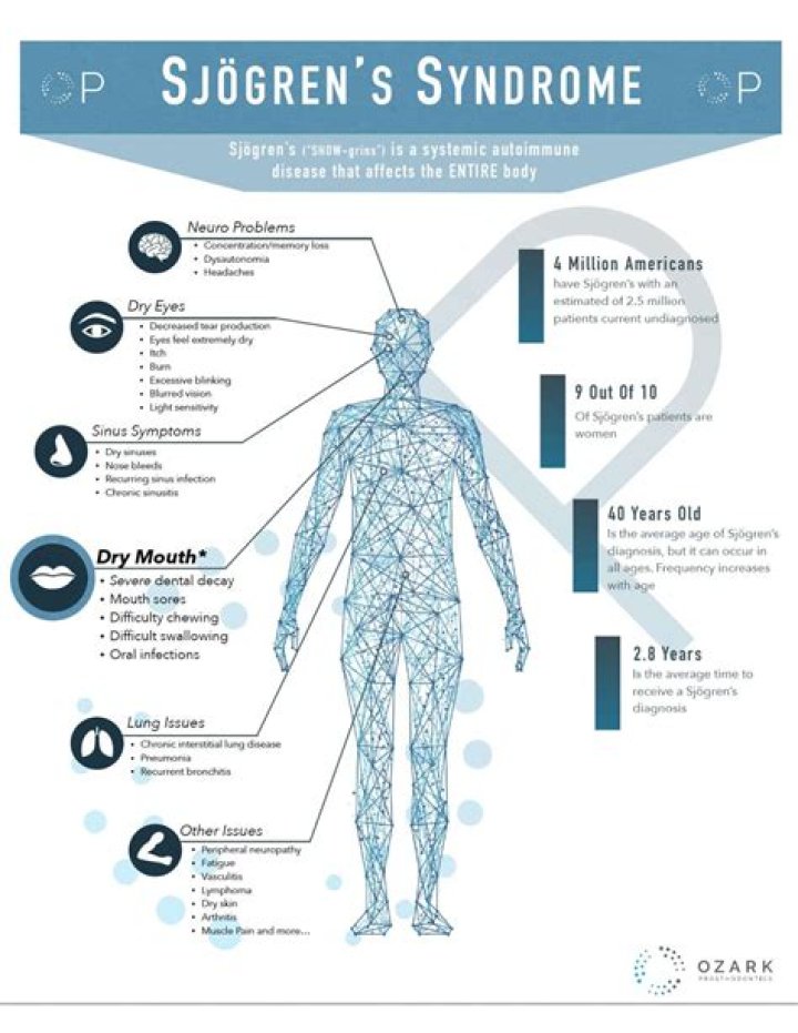 Does Sjogren's make you feel sick?