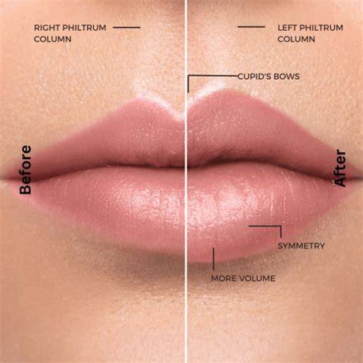 How can I make my lips prettier?