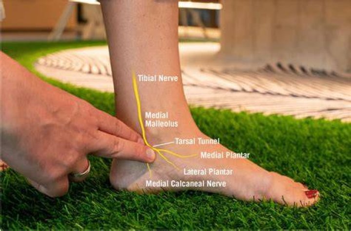 How do I know if I have nerve damage in my foot?