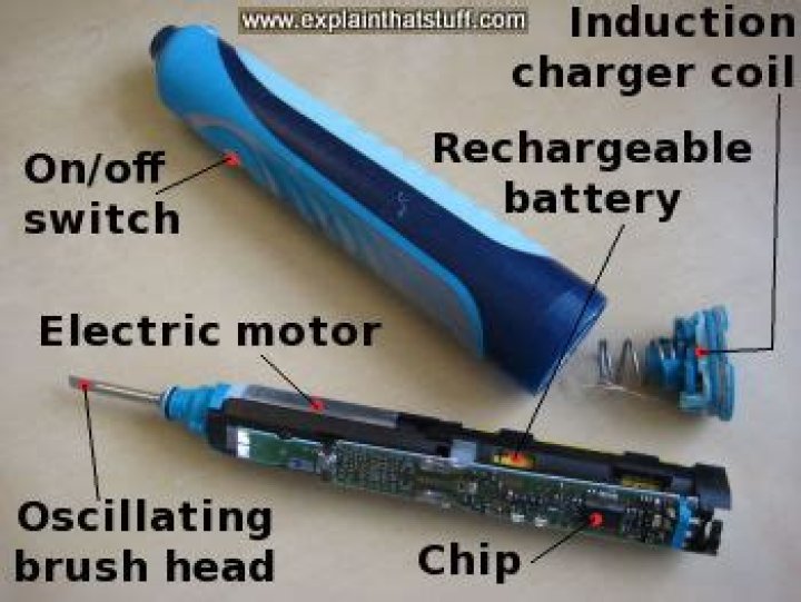 How do sonic toothbrushes work?