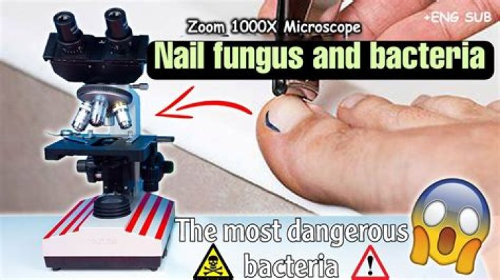 How do you get rid of bacteria under your nails?