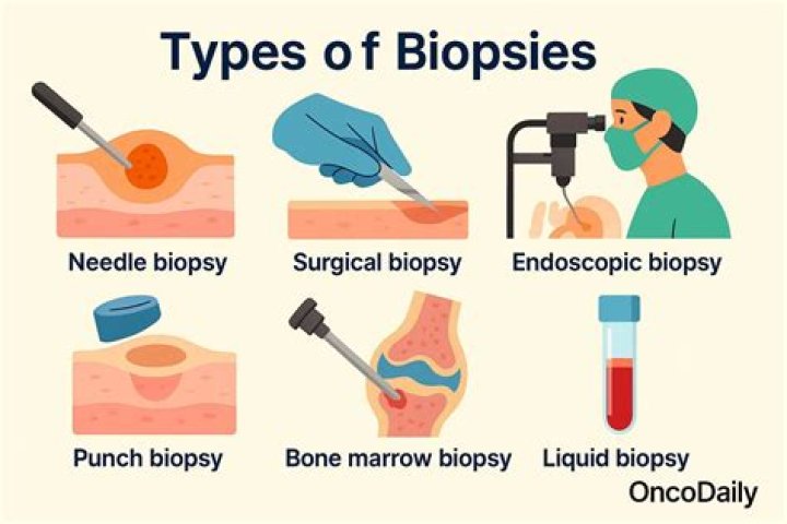 How long does a lung biopsy take to perform?