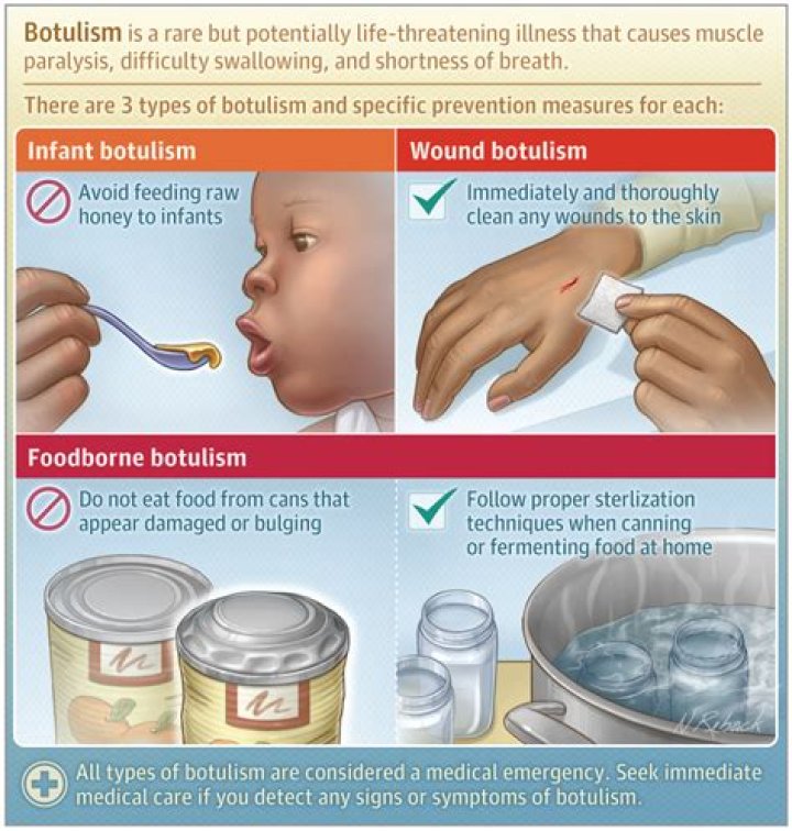 How long does botulism take to grow in a jar?