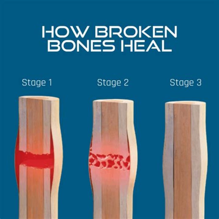 How long does it take for bone broth to heal your gut?