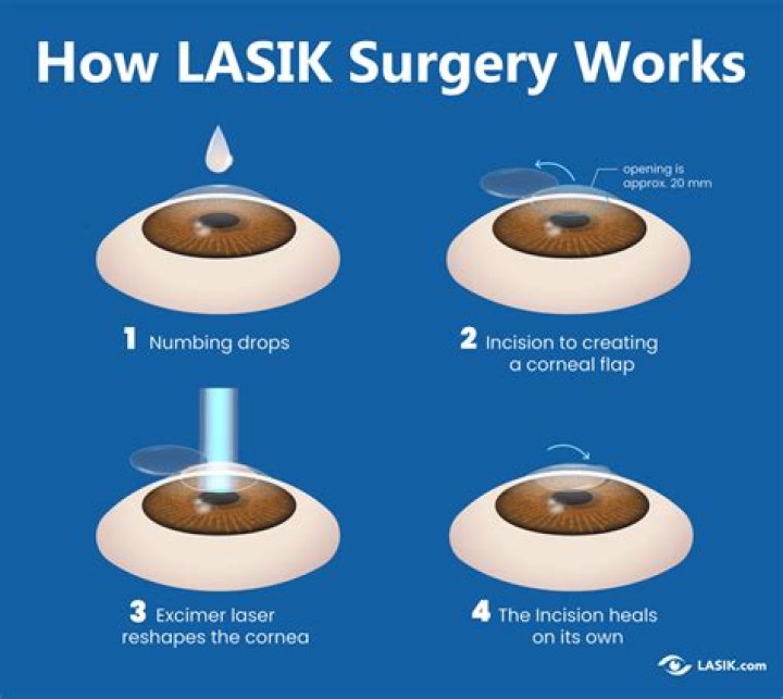How many days should I rest after LASIK?