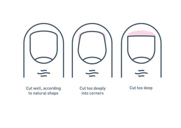 How often should toenails be cut?