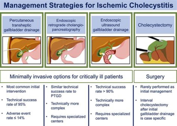 Is acute cholecystitis an emergency?