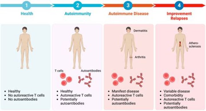 Is eczema autoimmune Related?