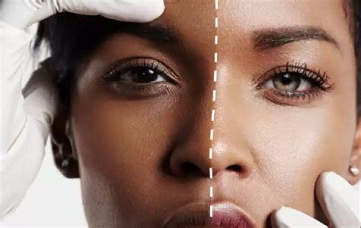 Is Korean skin bleaching permanent?