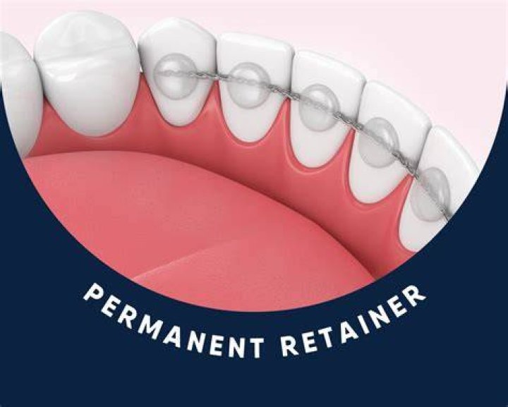 Should I wear my old retainer if it hurts?