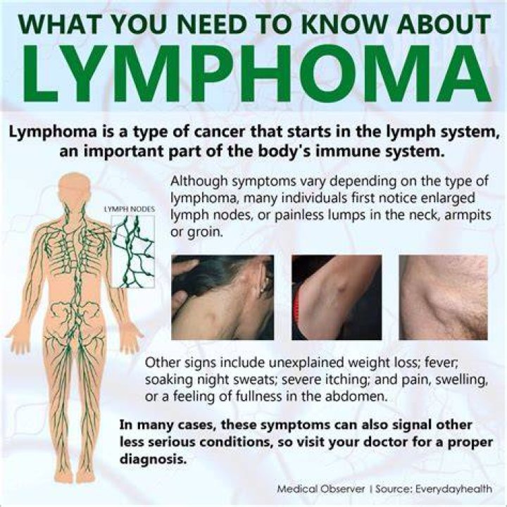 What are symptoms of swollen lymph nodes?