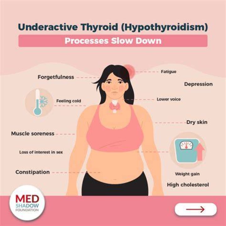 What are the long term effects of untreated hypothyroidism?