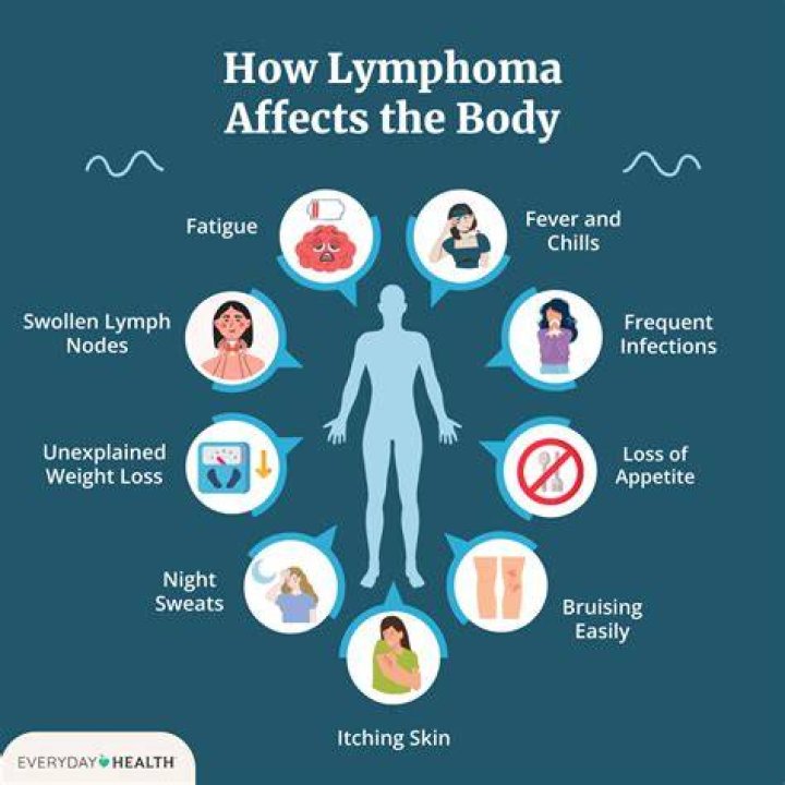 What are the symptoms of lymphoma of the stomach?