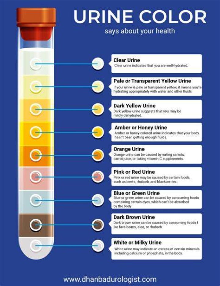 What color is urine with cirrhosis?