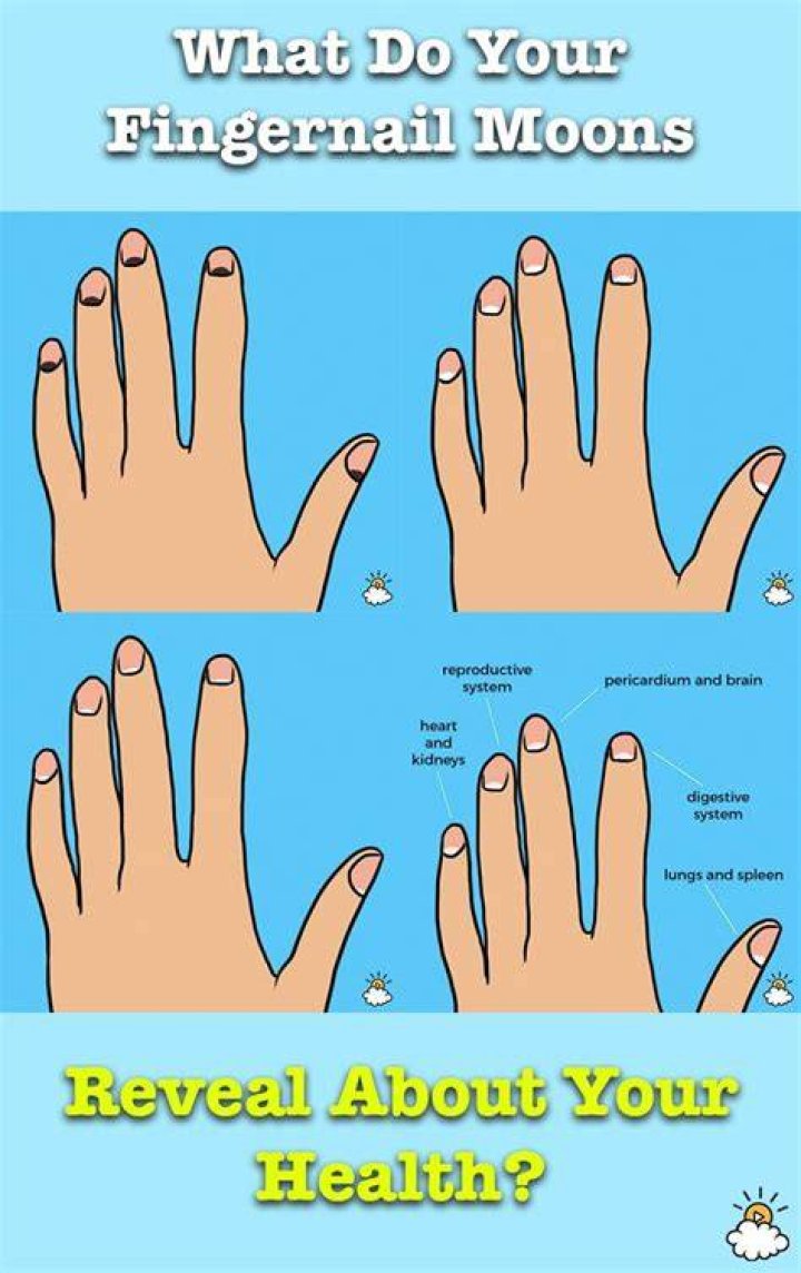 What do large moons on fingernails mean?