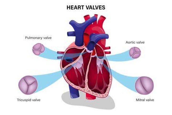What does a blocked heart valve feel like?