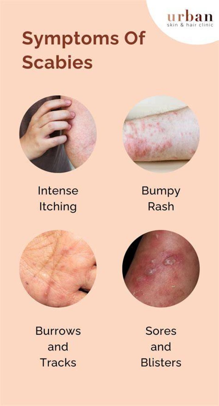 What does a scabies rash look like?