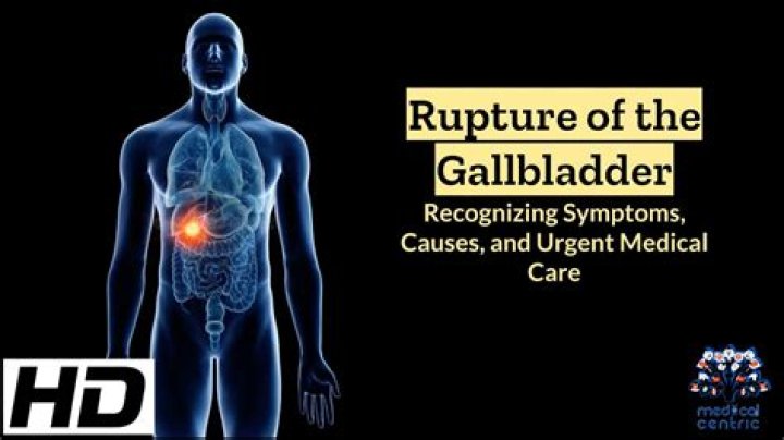 What happens if my gallbladder ruptures?