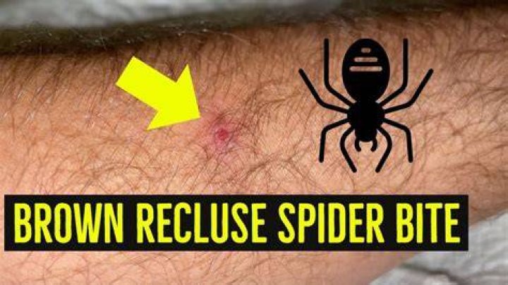What happens if you get bit by a maggot?