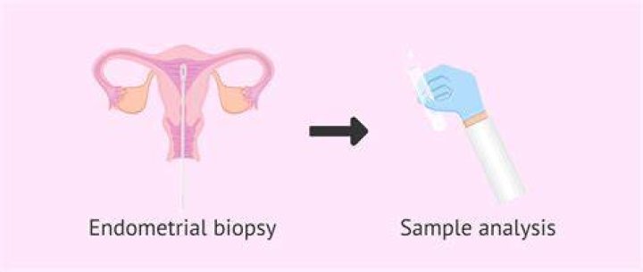 What happens if your endometrial biopsy is positive?