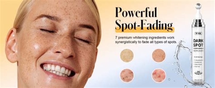 What is a good product to remove dark spots on face?