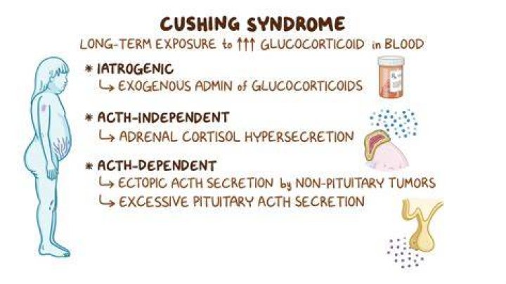 What is the life expectancy of someone with Cushing's syndrome?