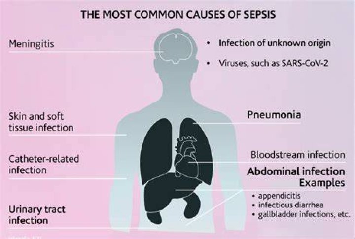 What is the most common cause of sepsis?