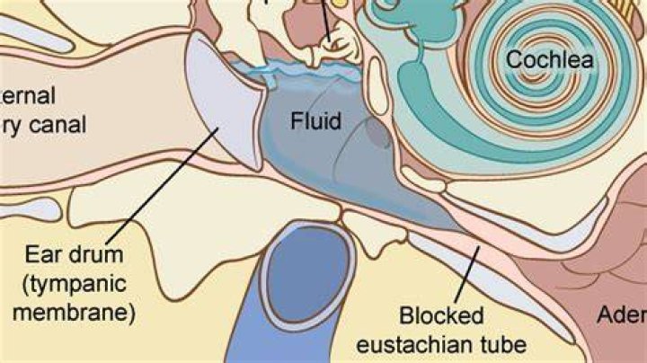 Why can I hear fluid in my neck?