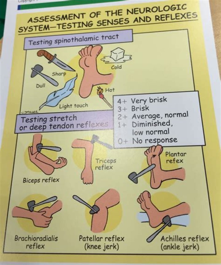 Why do doctors test reflexes?