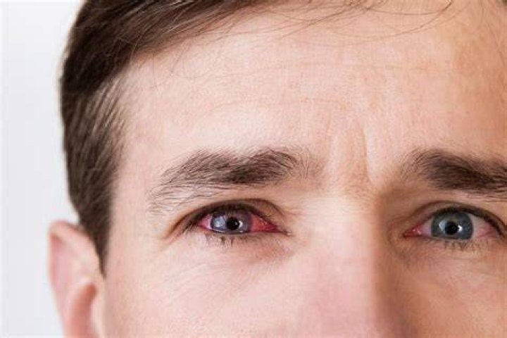 Why do I see red when I close my eyes in the sun?